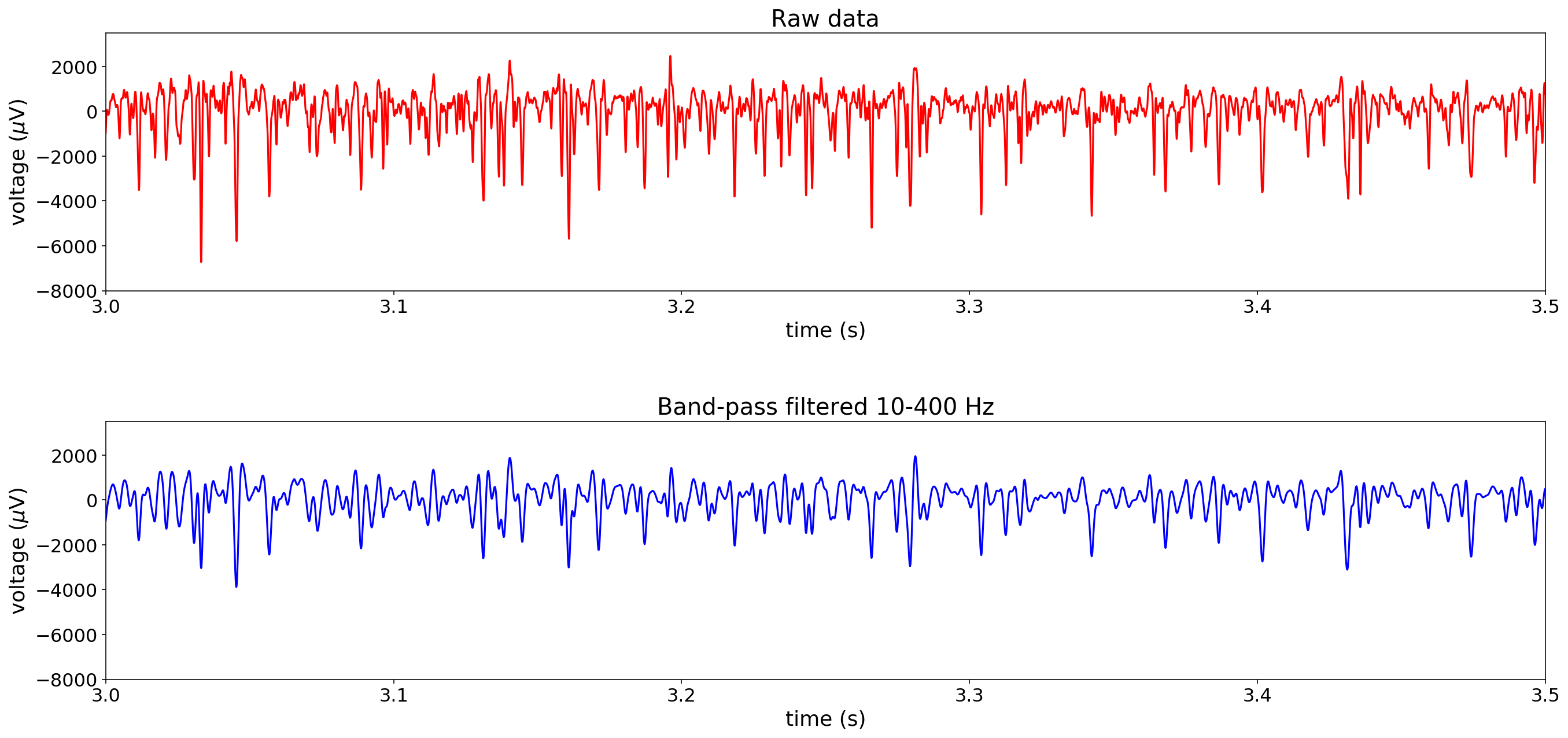 Ch. 3: Filtering, processing, and analyzing EMG data - Open-source ...